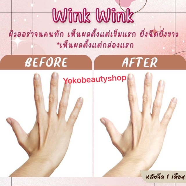 ٻҾ2 ͧԹ : Gluta WINK WINK?  Glutathione 33000000 mg  