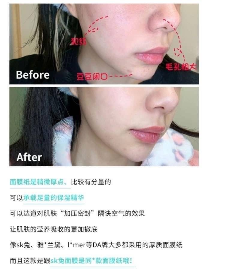 ٻҾ3 ͧԹ : Rejuran Recover Facial Mask 1 ͧ