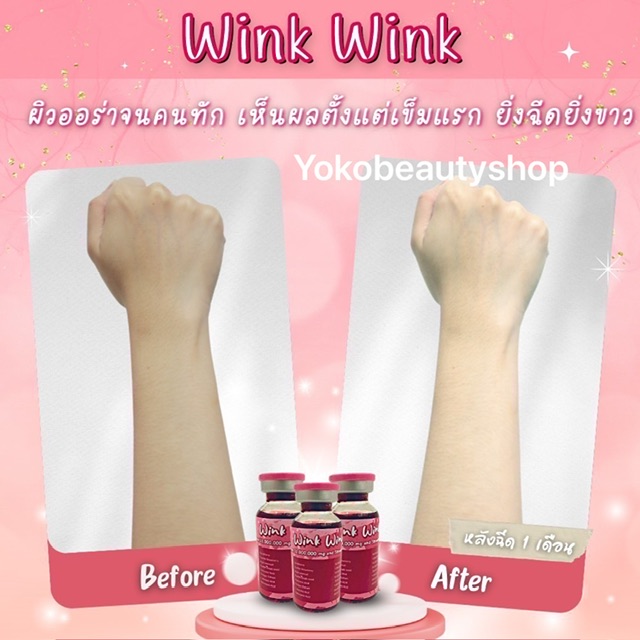 ٻҾ3 ͧԹ : Gluta WINK WINK?  Glutathione 33000000 mg  