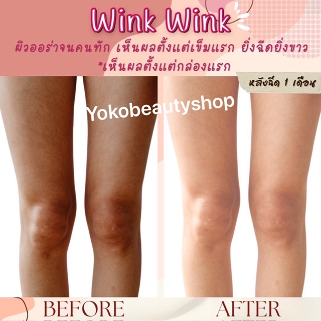 ٻҾ4 ͧԹ : Gluta WINK WINK?  Glutathione 33000000 mg  